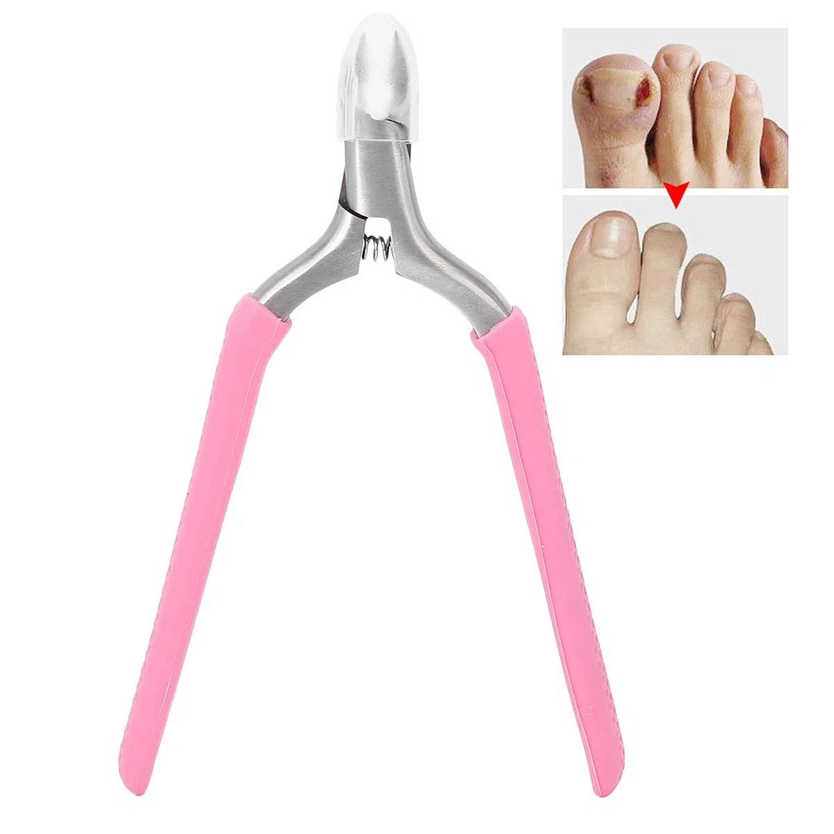 Tronchese Per Unghie Spesse Incarnite, Tronchese per Cuticole, taglia cuticole Nipper Tagliaunghie in acciaio inossidabile Strumento per la rimozione dei calli per la rimozione della pelle morta